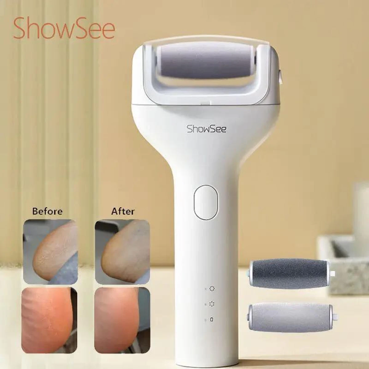 Xiaomi Showsee Electric Foot File Vacuum Callus Remover